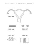 SYSTEMS, METHODS AND DEVICES FOR PERFORMING GYNECOLOGICAL PROCEDURES diagram and image