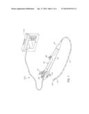 Distal Tip Channel Ramp diagram and image