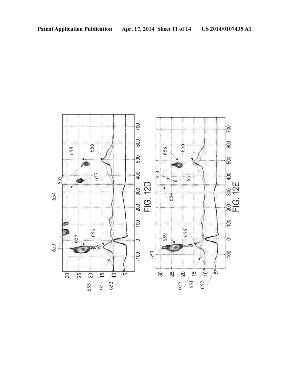 METHODS AND SYSTEMS OF AIMING SENSOR(S) FOR MEASURING CARDIAC PARAMETERS - diagram, schematic, and image 12