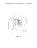 DEVICE AND METHOD FOR MONITORING OF ABSOLUTE OXYGEN SATURATION AND TISSUE     HEMOGLOBIN CONCENTRATION diagram and image