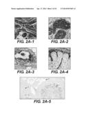 Dynamic MR Imaging of Patients with Breast Cancer -- Establishment and     Comparison of Different Analytical Methods for Tissue Perfusion and     Capillary Permeability diagram and image