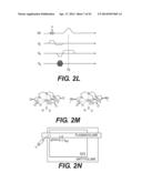 Dynamic MR Imaging of Patients with Breast Cancer -- Establishment and     Comparison of Different Analytical Methods for Tissue Perfusion and     Capillary Permeability diagram and image