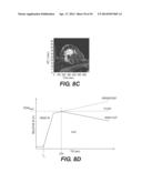 Dynamic MR Imaging of Patients with Breast Cancer -- Establishment and     Comparison of Different Analytical Methods for Tissue Perfusion and     Capillary Permeability diagram and image