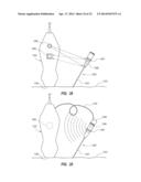 Apparatus for Use with Needle Insertion Guidance System diagram and image