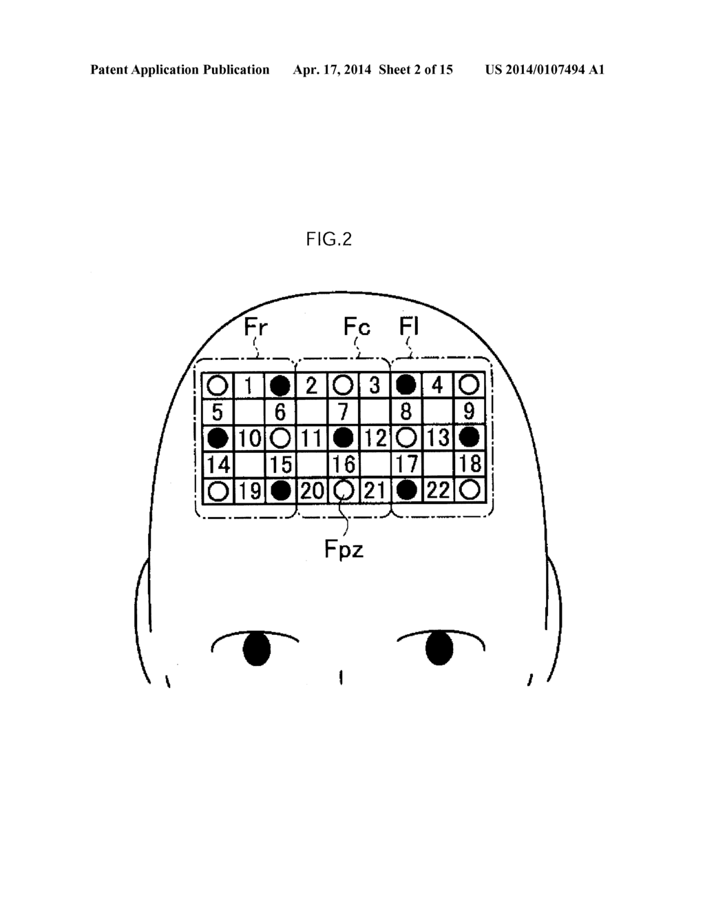 Cognitive Impairment Determination Apparatus, Cognitive Impairment     Determination System and Program - diagram, schematic, and image 03