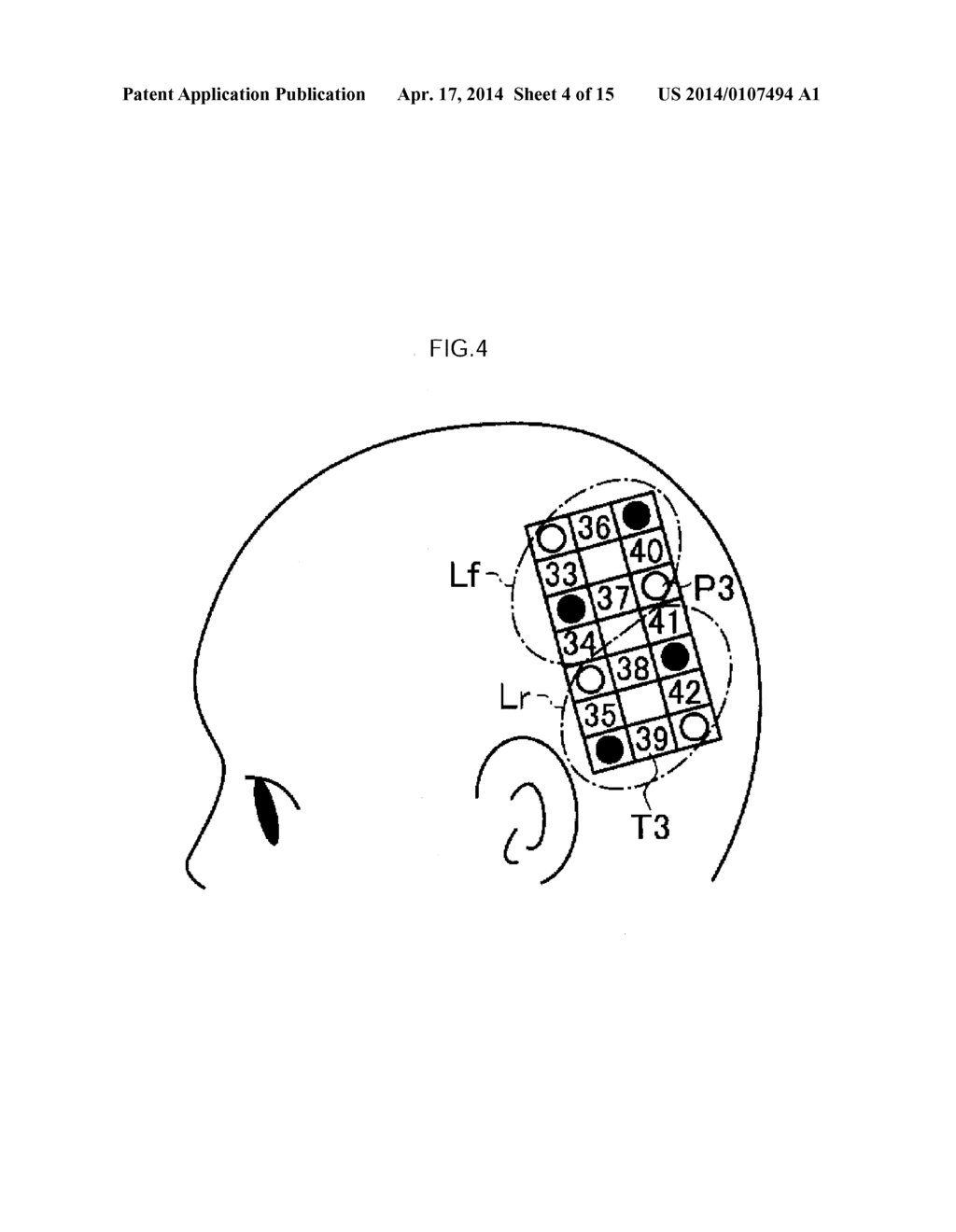 Cognitive Impairment Determination Apparatus, Cognitive Impairment     Determination System and Program - diagram, schematic, and image 05