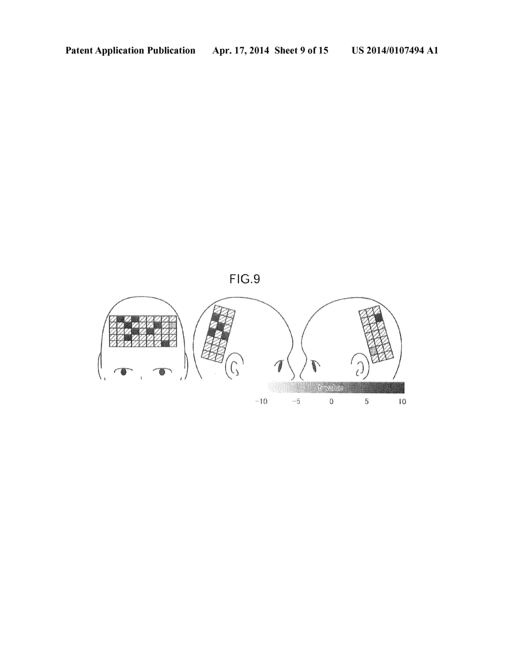 Cognitive Impairment Determination Apparatus, Cognitive Impairment     Determination System and Program - diagram, schematic, and image 10