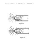 SENSING CATHETER EMITTING RADIANT ENERGY diagram and image