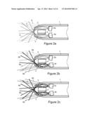 SENSING CATHETER EMITTING RADIANT ENERGY diagram and image