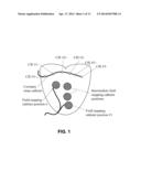 ELECTRODE DISPLACEMENT DETERMINATION diagram and image