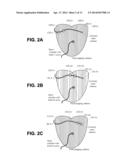 ELECTRODE DISPLACEMENT DETERMINATION diagram and image