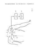 INTERNET-BASED SYSTEM FOR EVALUATING ECG WAVEFORMS TO DETERMINE THE     PRESENCE OF P-MITRALE AND P-PULMONALE diagram and image