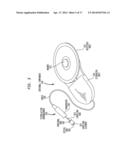 EVALUATION OF AN IMPLANTED PROSTHESIS diagram and image