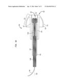 EVALUATION OF AN IMPLANTED PROSTHESIS diagram and image