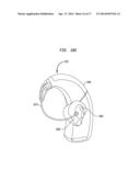 EVALUATION OF AN IMPLANTED PROSTHESIS diagram and image