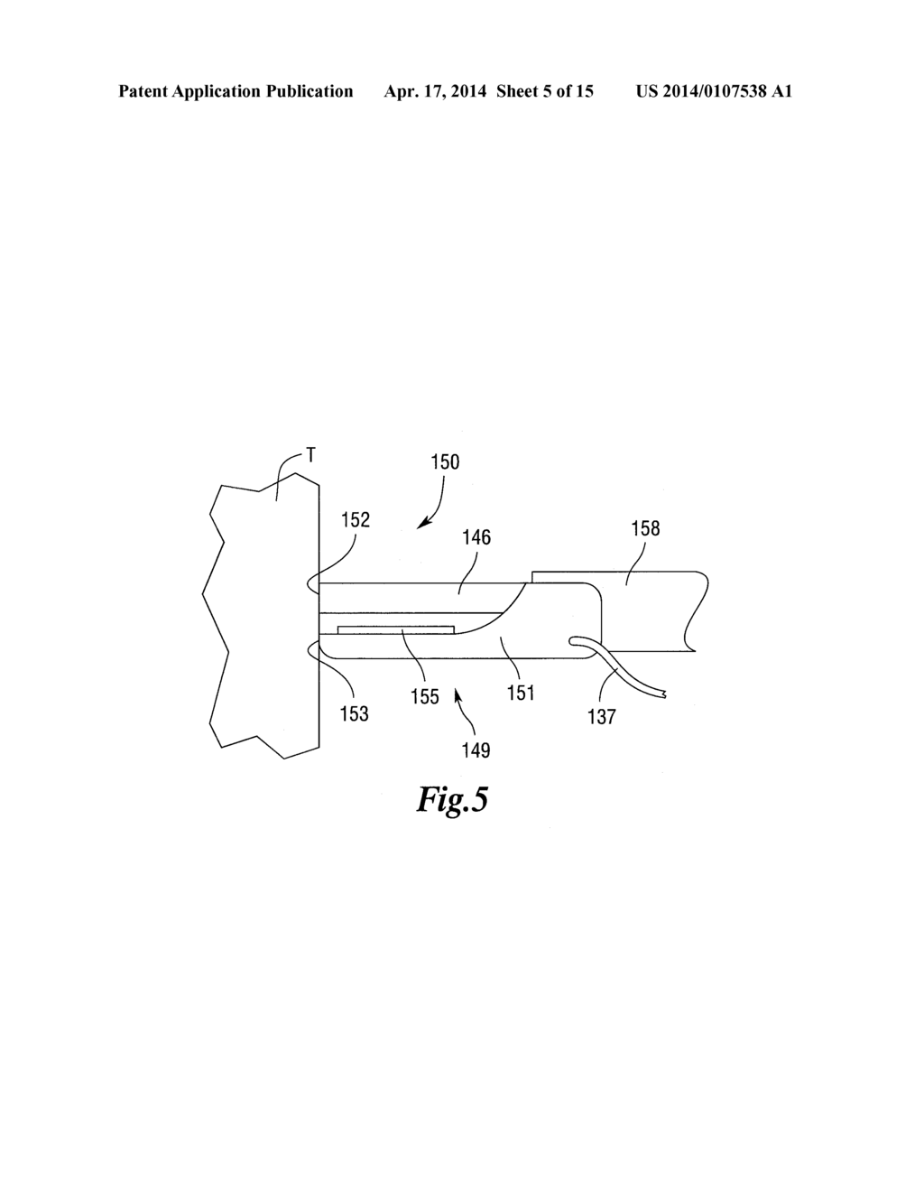 ULTRASONIC SURGICAL INSTRUMENTS - diagram, schematic, and image 06