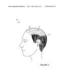 SCALP STIMULATION AND HAIR RE-GROWTH diagram and image