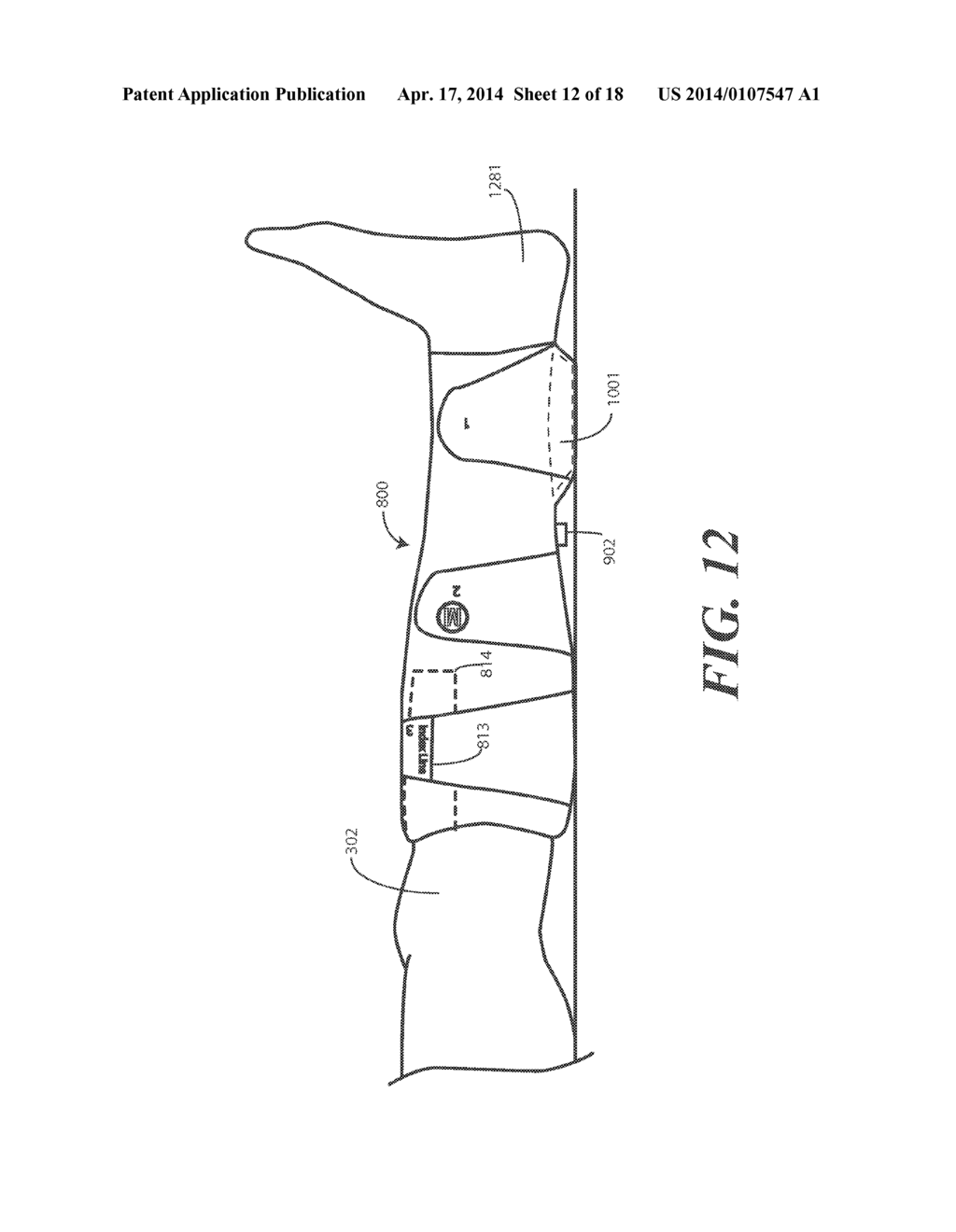 Heel Protector and Corresponding Rehabilitation Systems and Methods for     Using the Same - diagram, schematic, and image 13