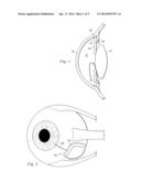 CAPILLARY ACTION IN FLOW-REGULATING SYSTEMS diagram and image