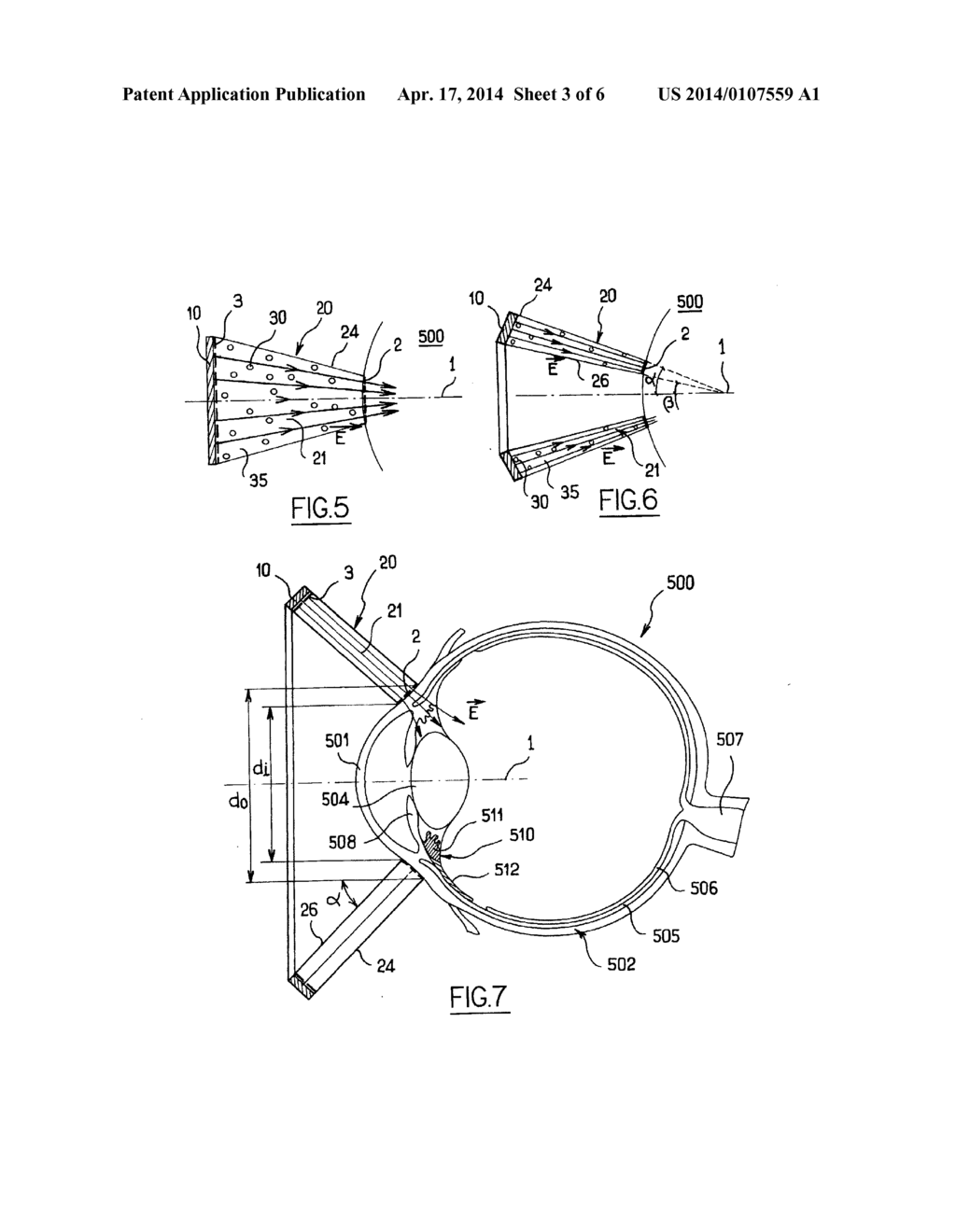 OCULAR IONTOPHORESIS DEVICE - diagram, schematic, and image 04