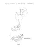 WOUND TREATMENT APPARATUS AND METHOD diagram and image