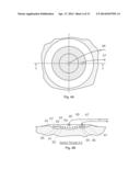 WOUND TREATMENT APPARATUS AND METHOD diagram and image