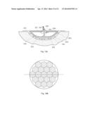 WOUND TREATMENT APPARATUS AND METHOD diagram and image