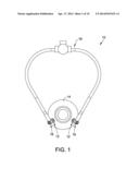 IRRIGATING CANNULA SYSTEM AND METHODS diagram and image