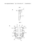 ORTHOPAEDIC PLATE AND SPREADER APPARATUSES AND METHODS diagram and image