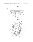 ORTHOPAEDIC PLATE AND SPREADER APPARATUSES AND METHODS diagram and image