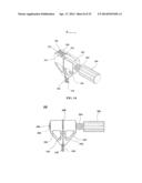 ORTHOPAEDIC PLATE AND SPREADER APPARATUSES AND METHODS diagram and image