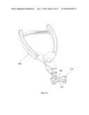 ORTHOPAEDIC PLATE AND SPREADER APPARATUSES AND METHODS diagram and image