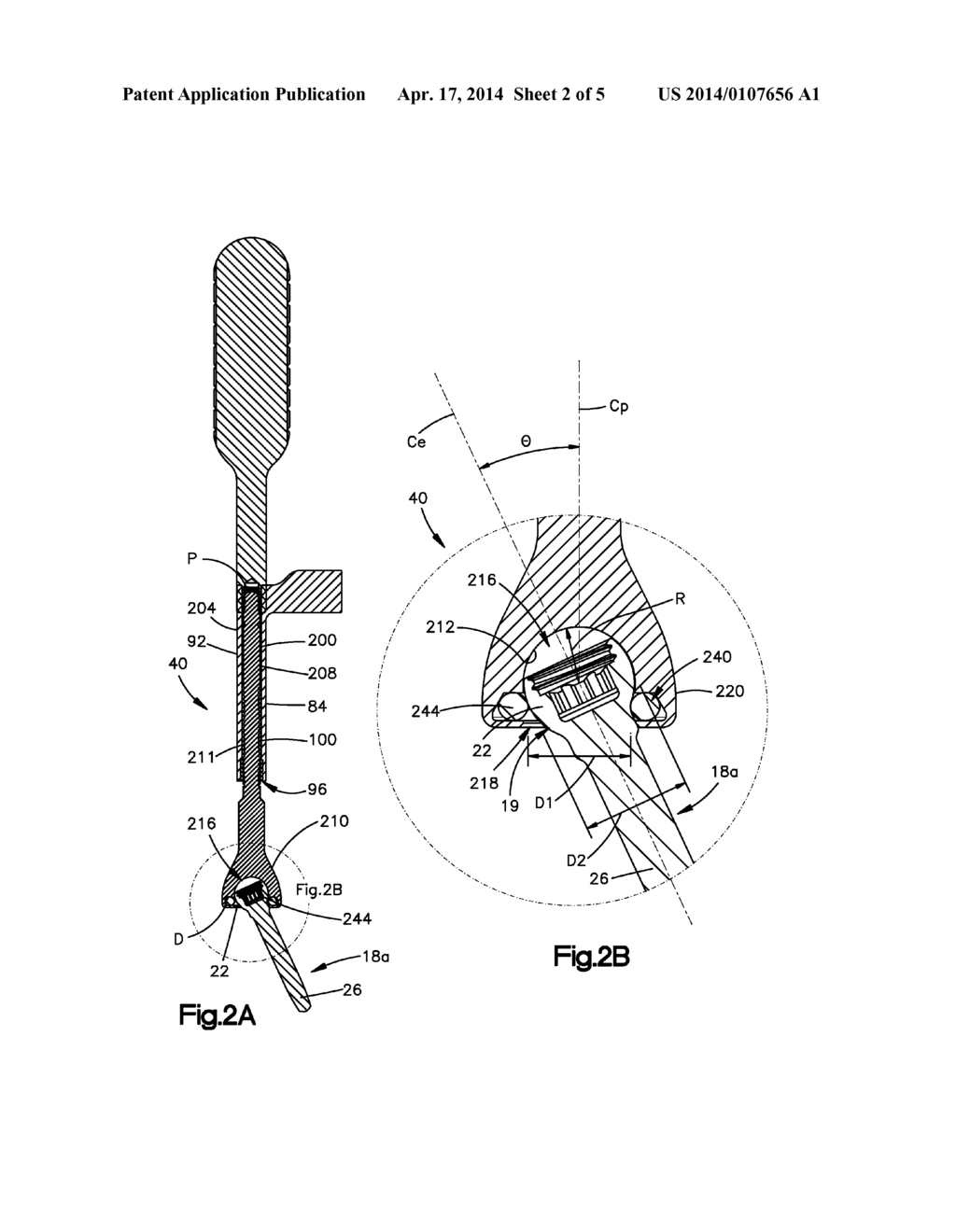 POP ON SPREADER SYSTEM - diagram, schematic, and image 03