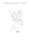 POP ON SPREADER SYSTEM diagram and image