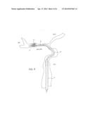 DEVICES AND METHODS FOR ACCESSING A CEREBRAL VESSEL diagram and image