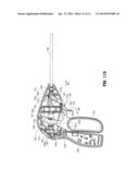 SURGICAL INSTRUMENT diagram and image