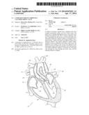 CATHETER GUIDANCE THROUGH A CALCIFIED AORTIC VALVE diagram and image