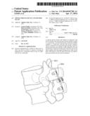 SPINOUS PROCESS DEVICE AND METHOD OF USE diagram and image