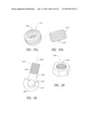 SPINOUS PROCESS DEVICE AND METHOD OF USE diagram and image