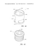 SPINOUS PROCESS DEVICE AND METHOD OF USE diagram and image