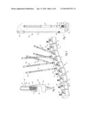 TABLE ANCHORED SCOLIOSIS DE-ROTATION SYSTEM AND METHOD diagram and image