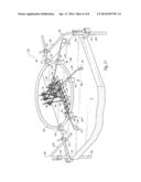 TABLE ANCHORED SCOLIOSIS DE-ROTATION SYSTEM AND METHOD diagram and image