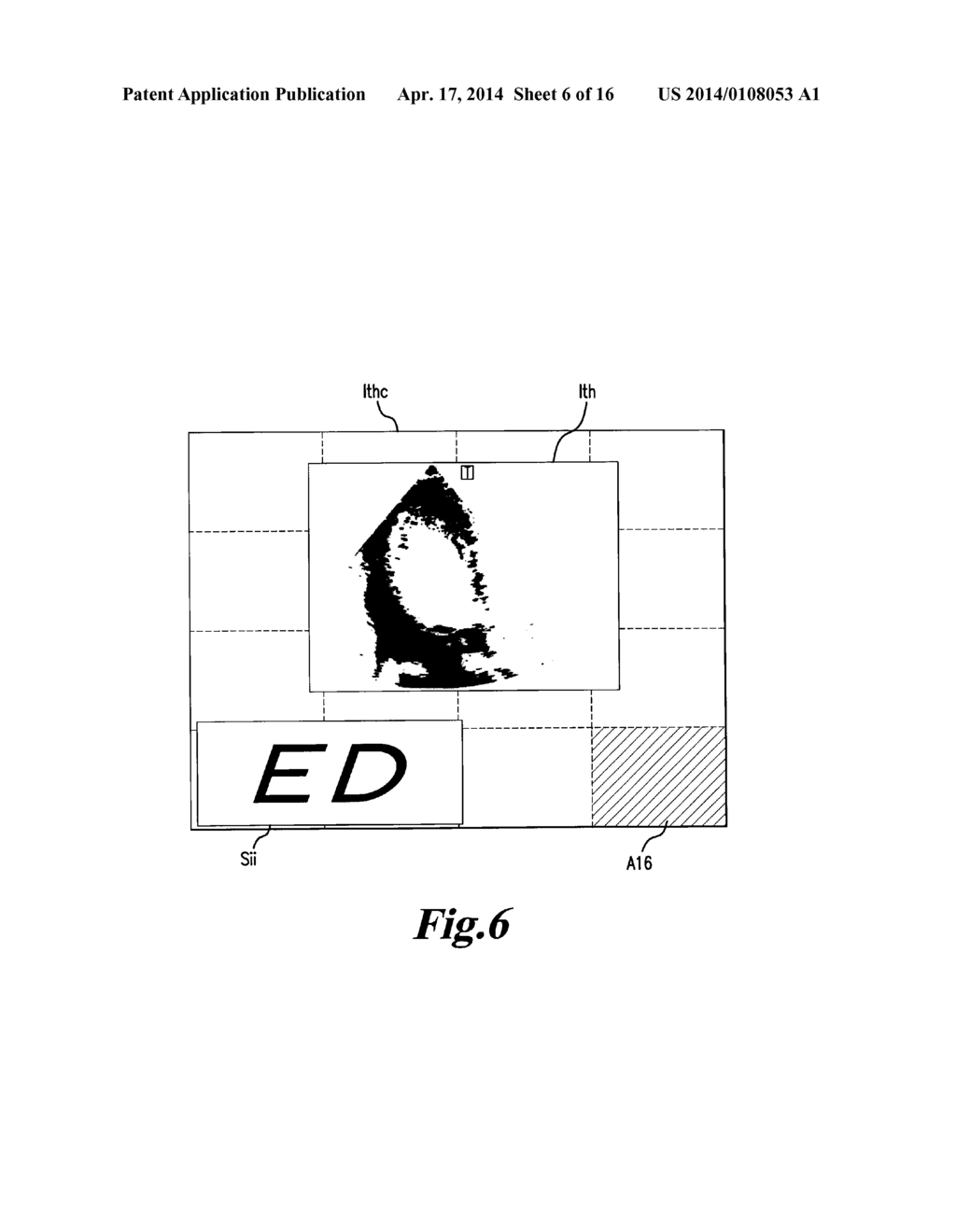 MEDICAL IMAGE PROCESSING APPARATUS, A MEDICAL IMAGE PROCESSING METHOD, AND     ULTRASONIC DIAGNOSIS APPARATUS - diagram, schematic, and image 07