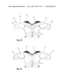 SHOULDER PADS INCORPORATING A CERVICAL SPINE PROTECTION DEVICE diagram and image