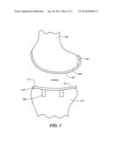 IMPLANT DEVICE AND METHOD FOR MANUFACTURE diagram and image