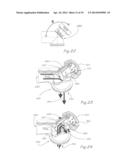 RESPIRATORY VALVE APPARATUS diagram and image