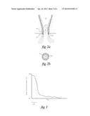 ENHANCED SYSTEM FOR SAND CLEANING IN A HYDROCYCLONE diagram and image