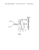 DIGITAL CIRCUIT ARRANGEMENTS FOR AMBIENT NOISE-REDUCTION diagram and image