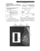 Breast Tomosynthesis with Display of Highlighted Suspected Calcifications diagram and image