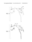 AUTOMATIC ANGIOGRAM DETECTION diagram and image